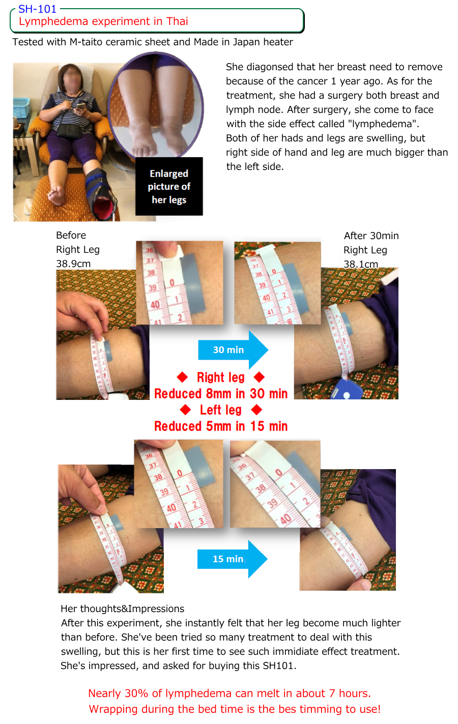 Lymphedema experiment in Thai [SH-101] Tested with M-taito ceramic sheet and Made in Japan heater. She diagonsed that her breast need to remove because of the cancer 1 year ago. As for the treatment, she had a surgery both breast and lymph node. After surgery, she come to face with the side effect called lymphedema. Both of her hads and legs are swelling, but right side of hand and leg are much bigger than the left side. Her thoughts&Impressions After this experiment, she instantly felt that her leg become much lighter than before. She've been tried so many treatment to deal with this swelling, but this is her first time to see such immidiate effect treatment. She's impressed, and asked for buying this SH101. Nearly 30% of lymphedema can melt in about 7 hours. Wrapping during the bed time is the bes timming to use!